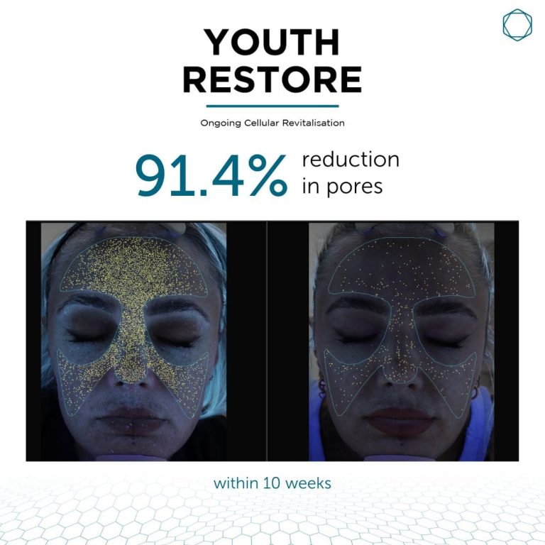 Youth Restore (Inquire Now) - Image 6